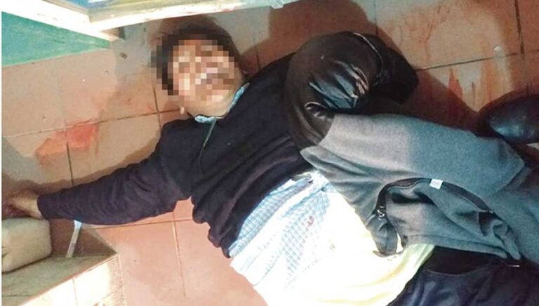 La Rinconada: Policía investiga caso de varón que fue asesinado de un disparo en el tórax