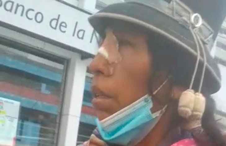 Mujer pide ayuda para denunciar a su vecino
