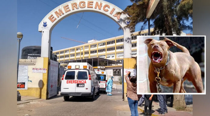 Niña de 2 años termina con fractura y rostro desfigurado tras ataque de pitbull