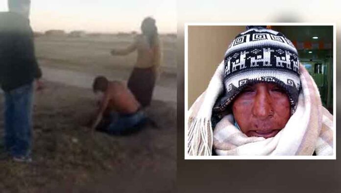 Padre pide justicia luego que su hija y pareja lo agredan salvajemente en Juliaca