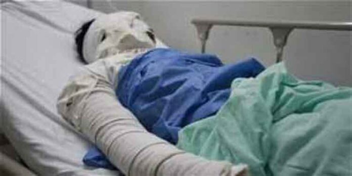 Puno: Familiares piden apoyo económico para tratamiento de técnico electrocutado