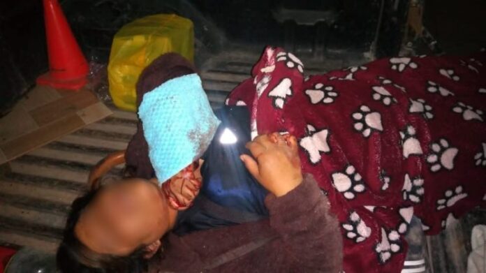 Mujer se salva de ser víctima de feminicidio, su pareja le realizó cortes con cuter