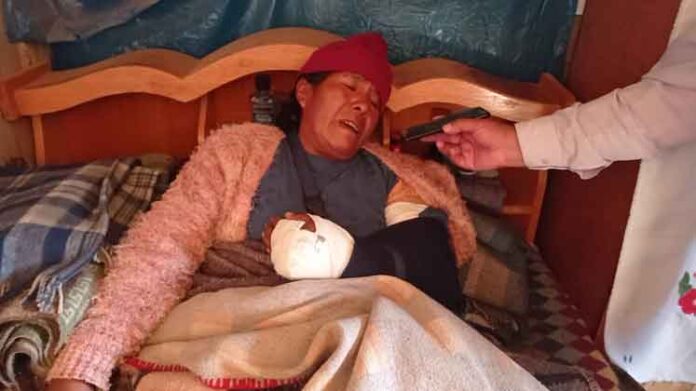 San Miguel: Mujer que fue agredida por su expareja teme por su vida la de sus hijas