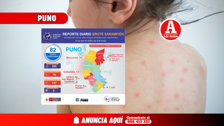 A 82 se incrementan los casos confirmados de sarampión
