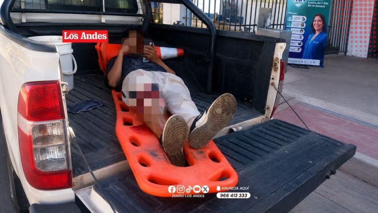 Hombre resulta herido tras ser atropellado en Juliaca y conductor huye